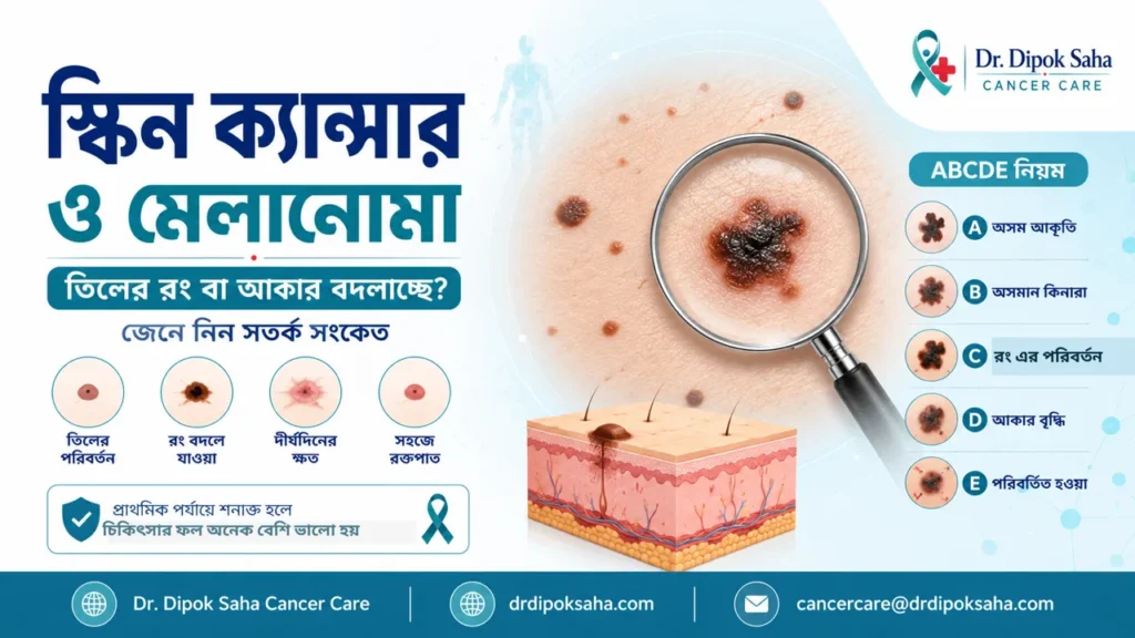 স্কিন ক্যান্সার ও মেলানোমা সম্পর্কে বাংলা সচেতনতামূলক পোস্টার যেখানে তিলের পরিবর্তন, ABCDE নিয়ম এবং ত্বকের ক্যান্সারের সতর্ক সংকেত দেখানো হয়েছে